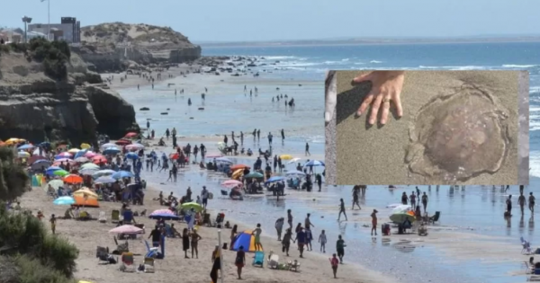 Más de 70 personas sufrieron picaduras de aguas vivas en Las Grutas Más de 70 personas sufrieron picaduras de aguas vivas en Las Grutas