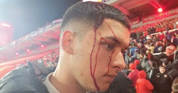 El parte médico de los hinchas chilenos heridos tras los incidentes en Avellaneda