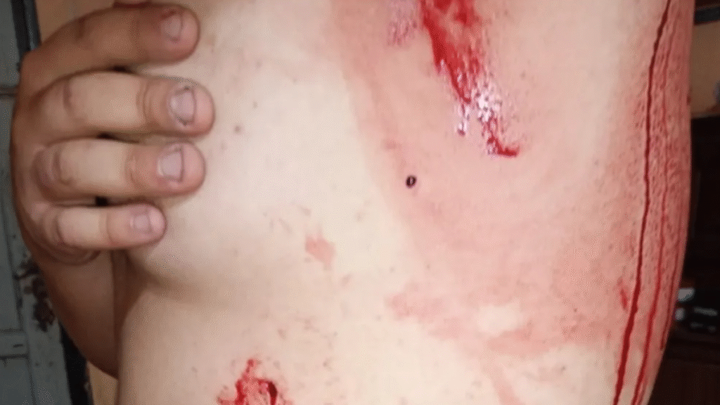 Apuñalaron a un joven que sorprendió a un ladrón en su casa
