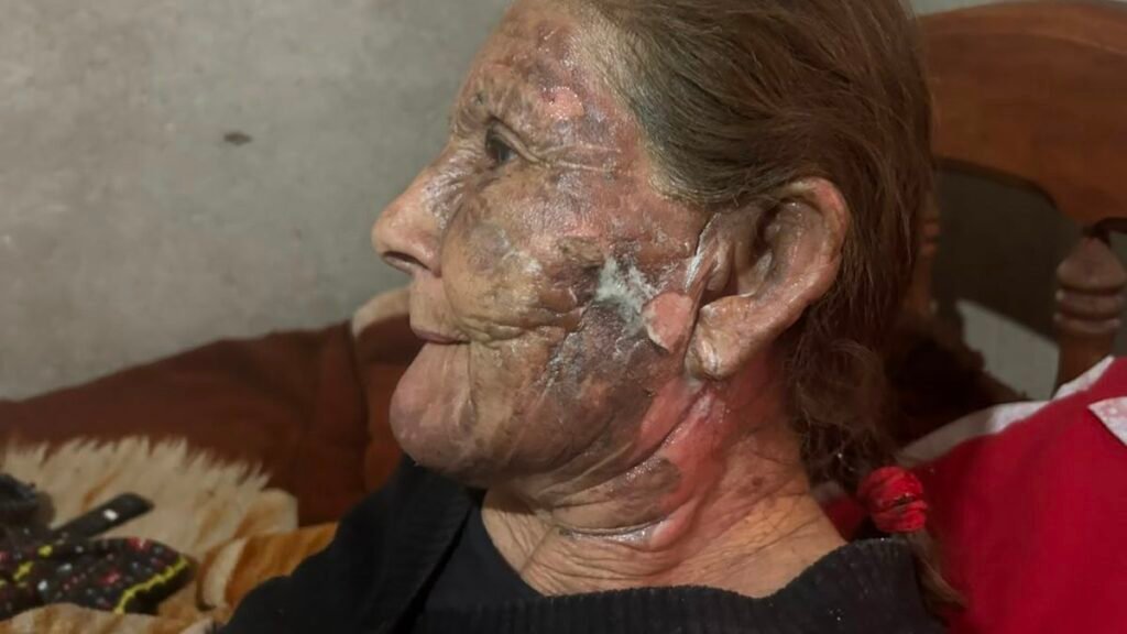 Quemó a su expareja y  lo imputaron por intento de homicidio agravado